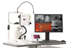 Heidelberg Spectralis OCT
