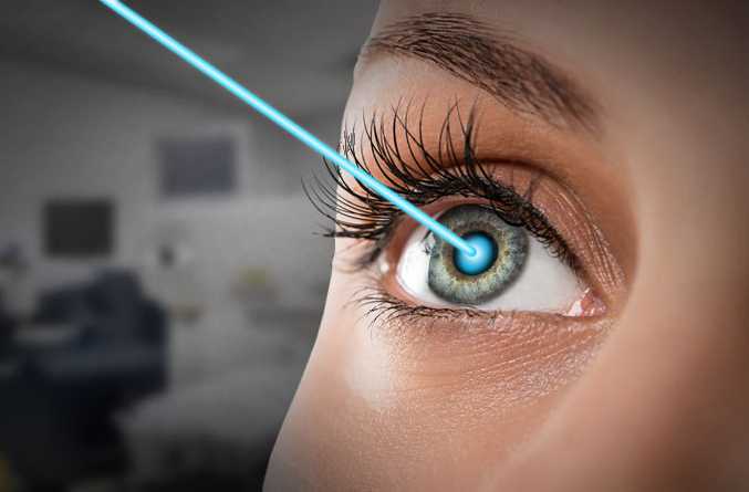 Refractive Surgeries